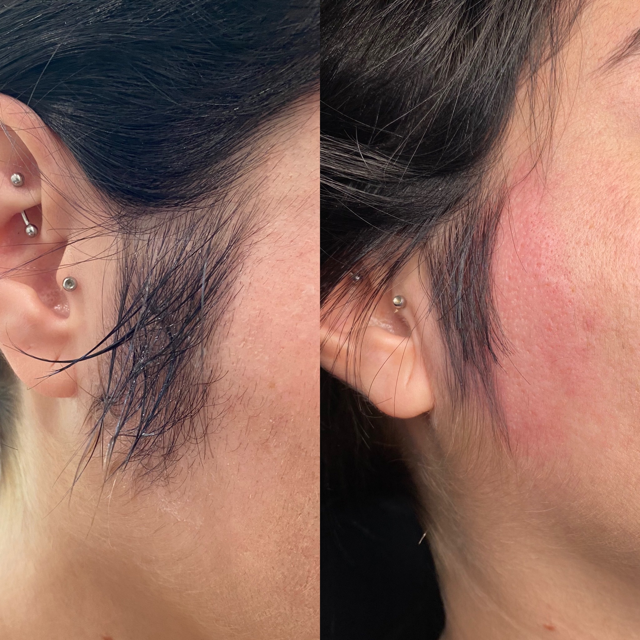 Client result