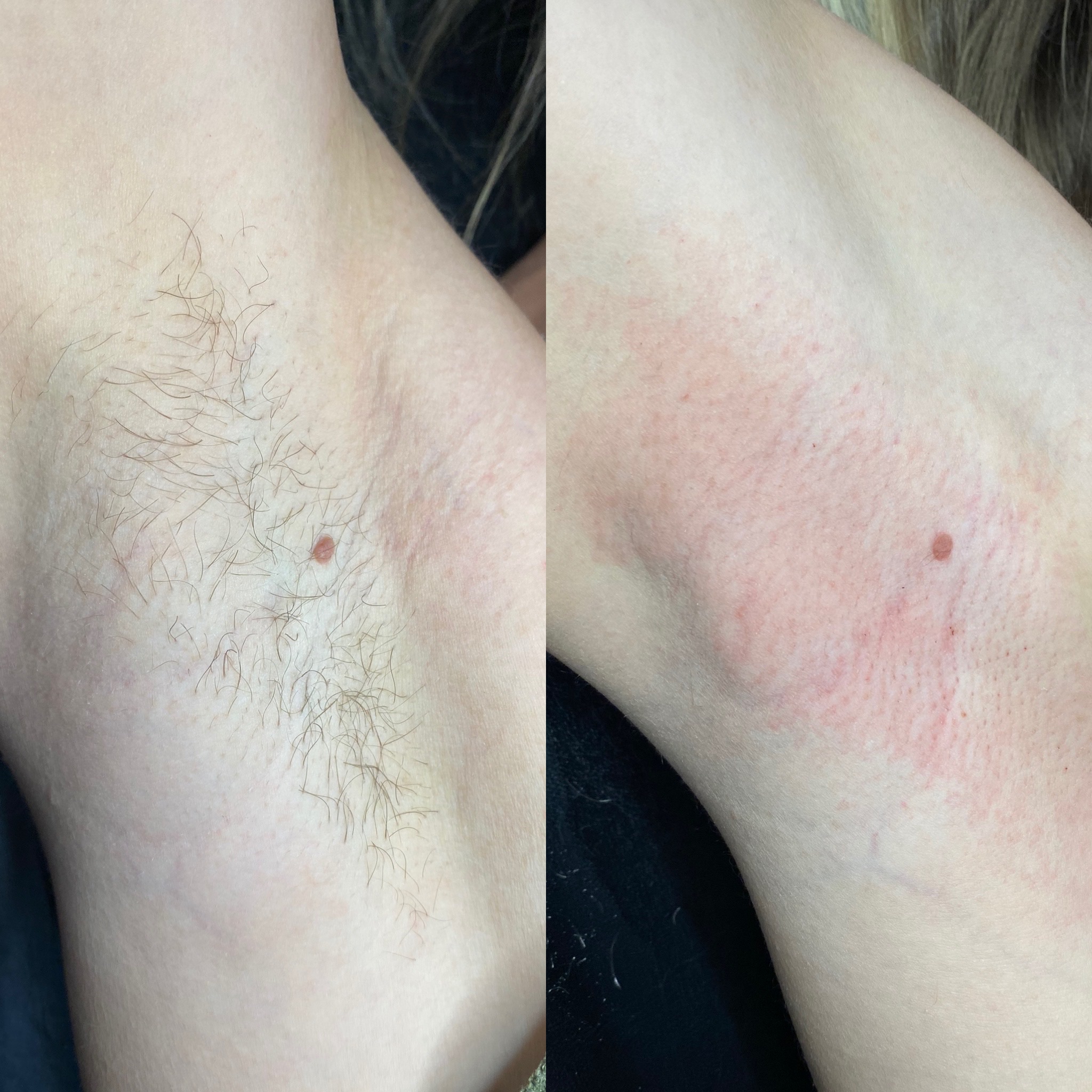 Client result